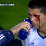 cristiano-ronaldo-levante-cruento-